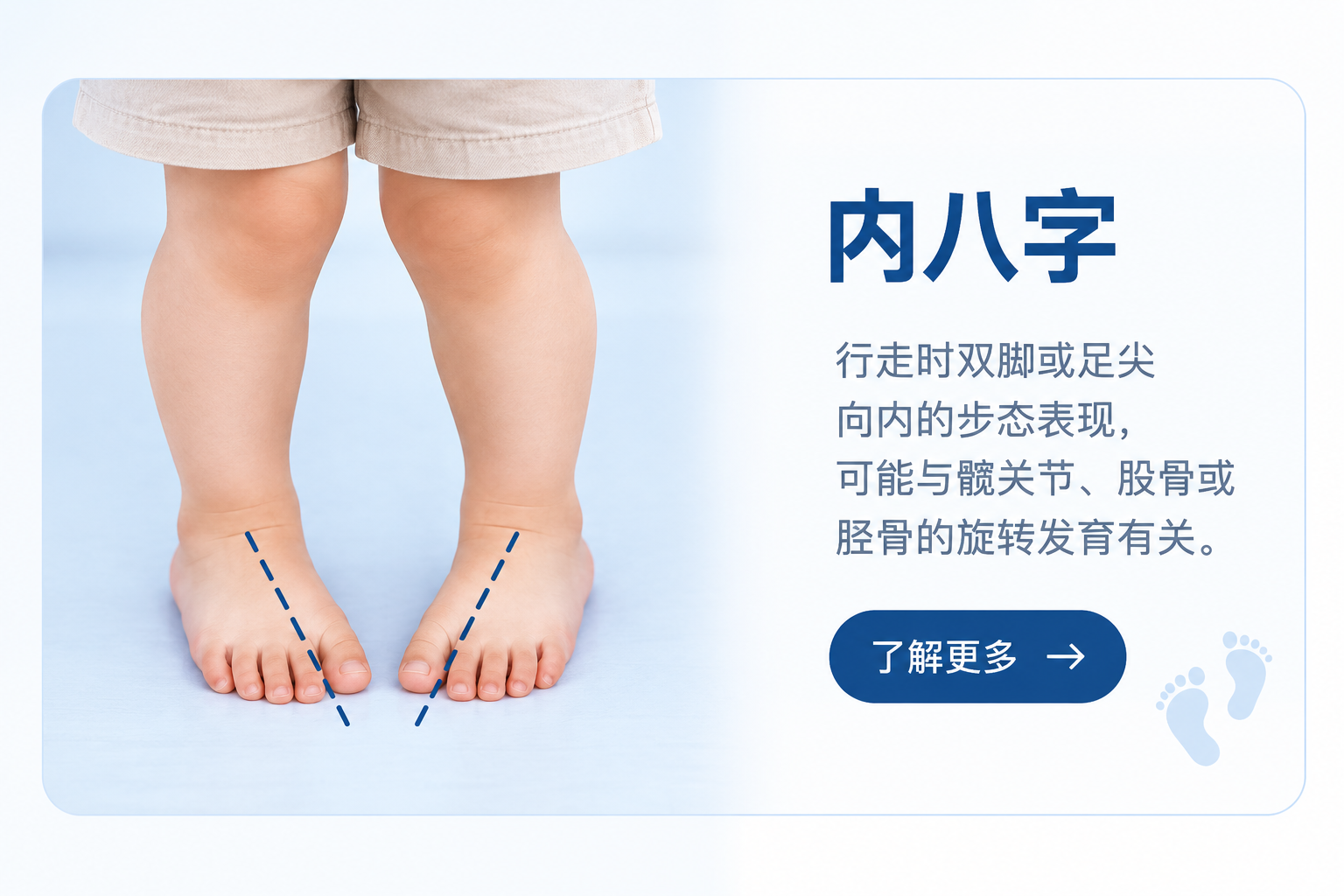 儿童内八字