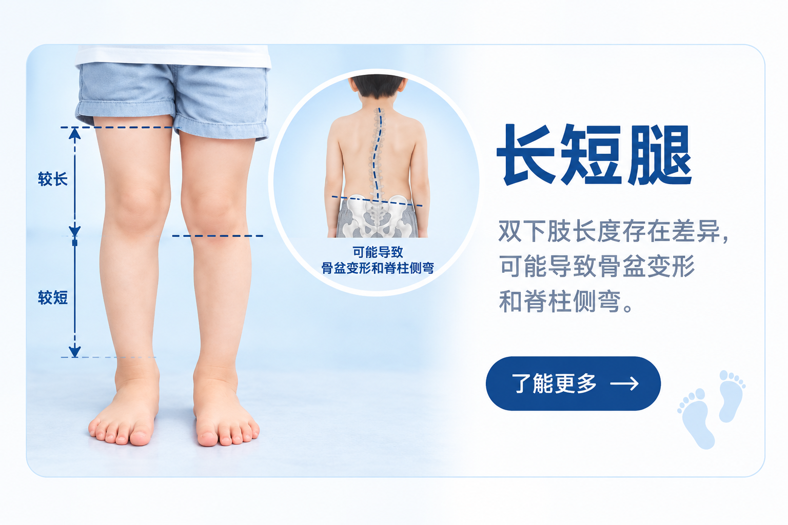 儿童长短腿